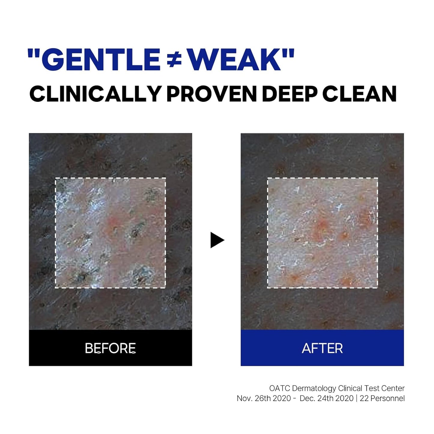 ROUND LAB Birch Juice Moisturizing Cleanser | Unclogs hidden sebum, Clears away dead skin cells., Soothing, Low pH, Gel Type Cleanser (5.07 fl.oz)